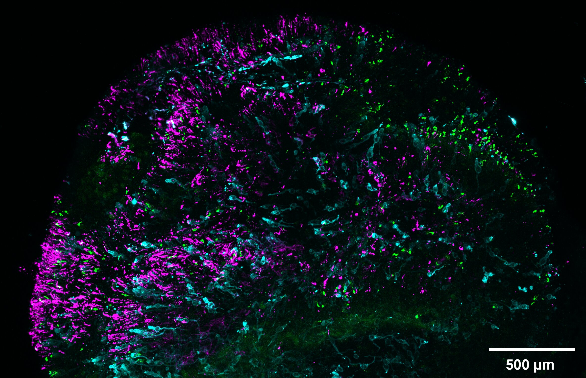 Uma retina cultivada em laboratório é marcada para mostrar cones azuis em ciano e cones verdes/vermelhos em verde. As células chamadas bastonetes que ajudam o olho a enxergar em condições de pouca luz ou escuridão são marcadas em magenta. (Sarah Hadyniak/Universidade Johns Hopkins)