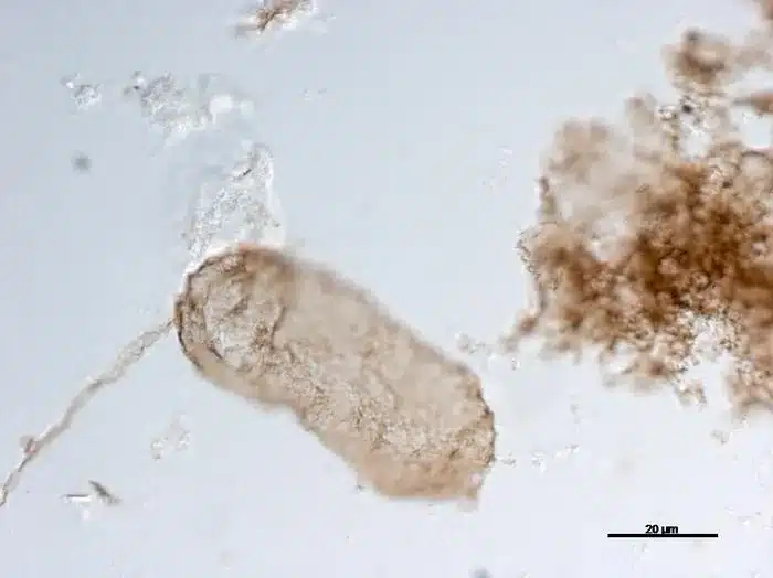 O microfóssil que fornece evidências da fotossíntese há 1,75 bilhão de anos. (Crédito da imagem: Emmanuelle Javaux)